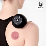 (싱글)온부기 무선 자동 온열 부항기