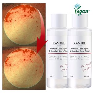 3일개선 기미토너 아세로라 잡티 기미 케어 토너 150ml 2개 저자극 테스트 완료