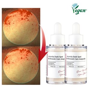 저속노화 3일 잡티케어 글루타치온 기미앰플 아세로라 잡티 기미 앰플 30ml 2개 / 임상완료 비타민C의 왕 아세로라 앰플