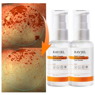 비타C 3일 잡티 17.4프로 순삭 톤업 세럼 잡티이별세럼+고농축 멀티비타민 기미 잡티 세럼 50ml 2개/ 비타민 C 고농축 잡티 순삭 케어